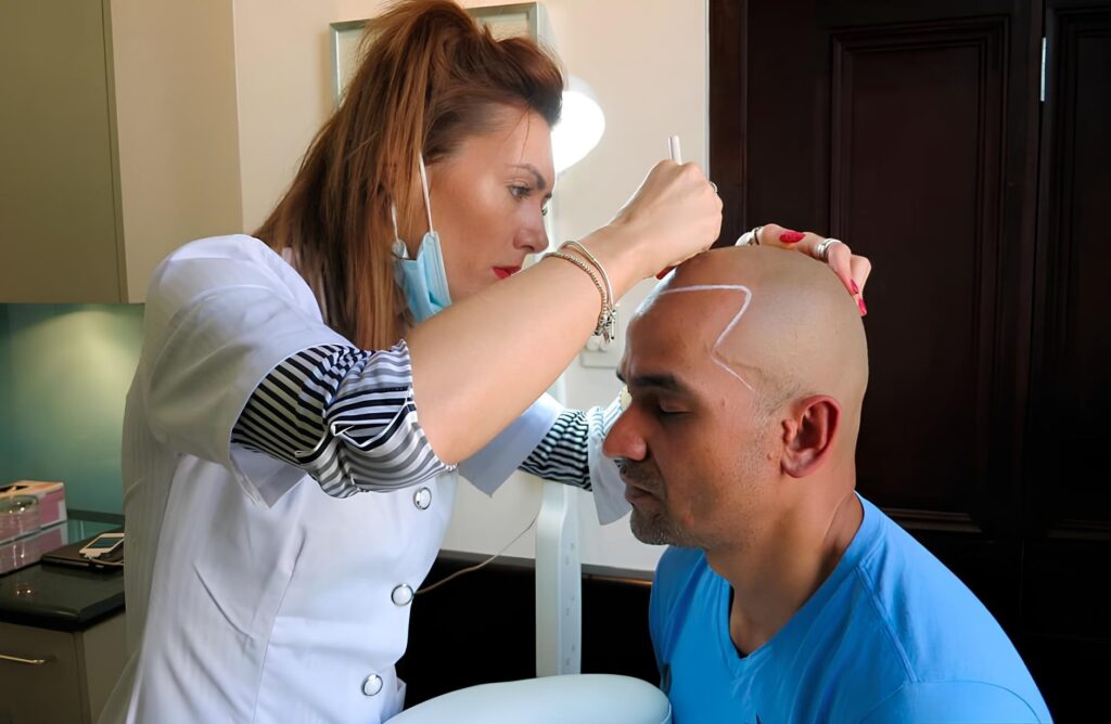 Look Younger with Scalp Micropigmentation Today