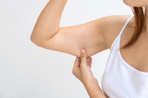 Underarm liposuction in Dubai