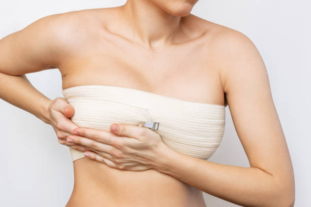 What Should I Expect During Breast Augmentation?