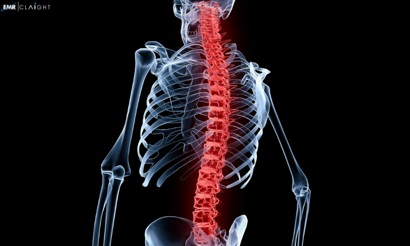 Global Chronic Lower Back Pain Treatment Market Share, Size, Growth, Trends, Outlook & Forecast | 2024 – 2032