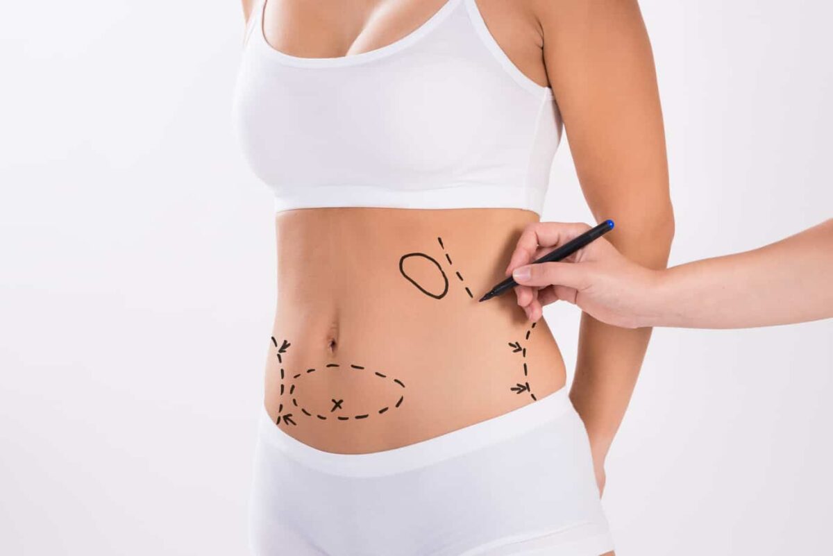 Reclaim Your Confidence: How a Tummy Tuck Can Change Your Life