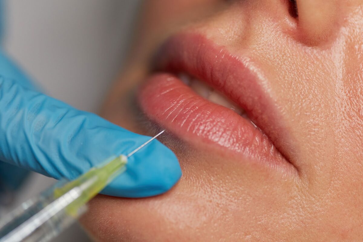 A Quick Guide to Choosing the Right Lip Filler