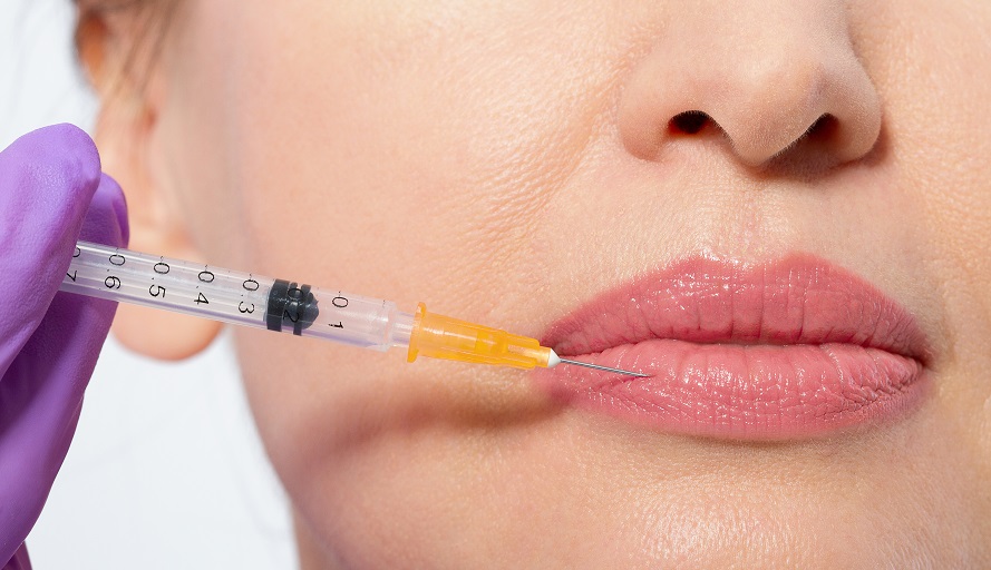 Are There Risks Associated with Lip Reduction Surgery?