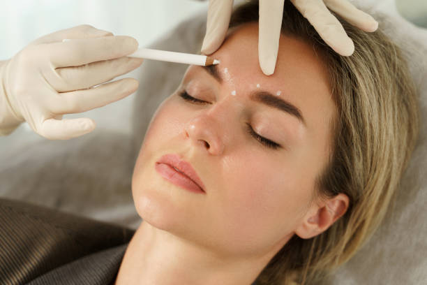 Botox Injection Sites for a Youthful Look