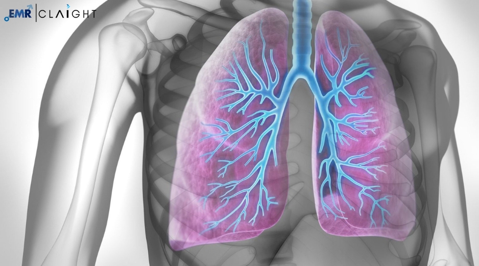 Global Lung Cancer Therapeutics Market