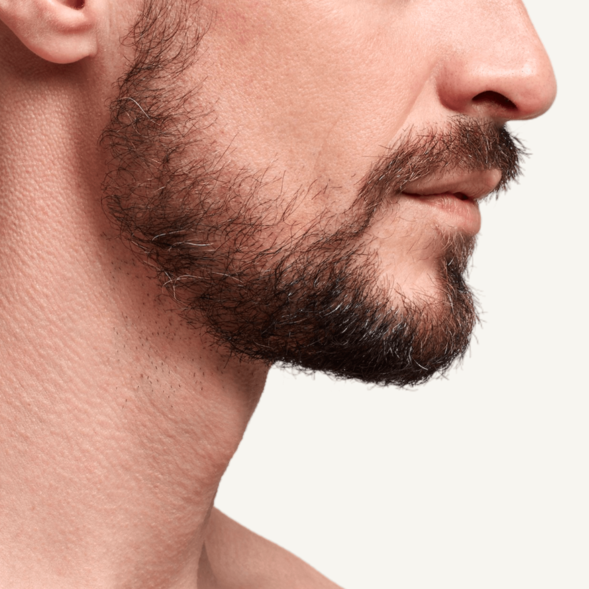 Say Goodbye to Patchy Beards with a Hair Transplant