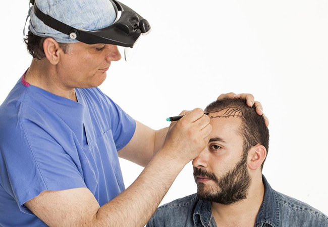 Hair Transplant Cost in Dubai