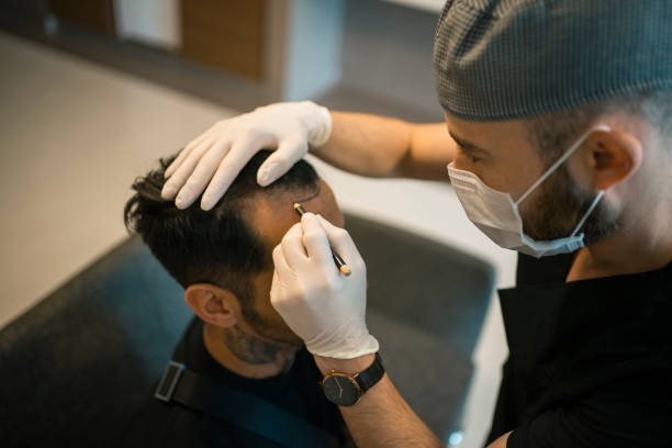 Hair transplant Cost