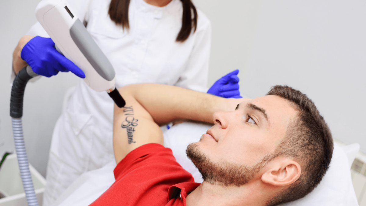 How Many Sessions Are Needed for Laser Tattoo Removal?