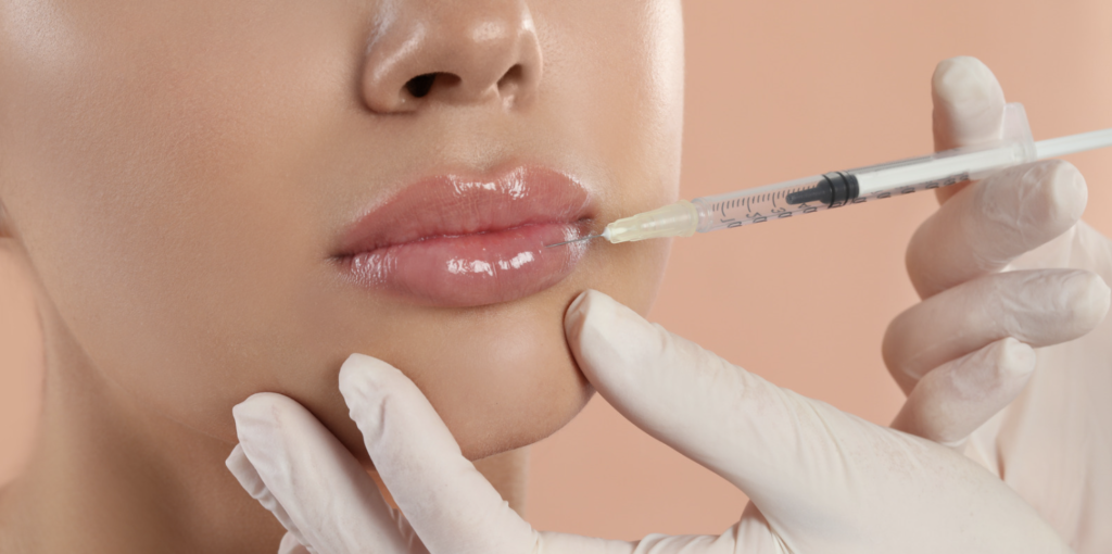 How long does lip augmentation last? 