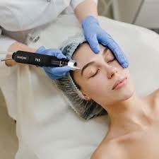 Laser Treatment in Dubai