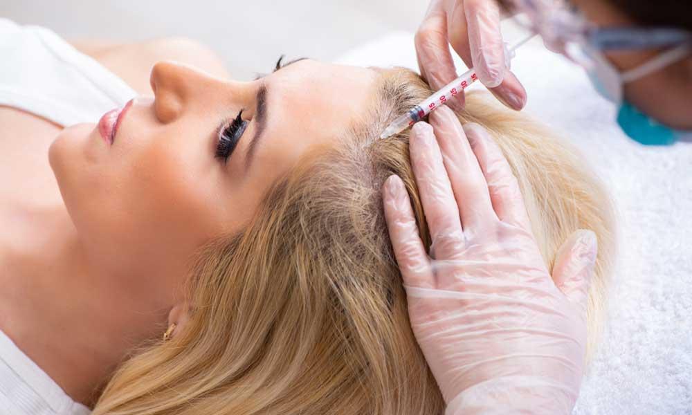 PRP Hair Treatment The Secret to Fuller, Healthier Hair