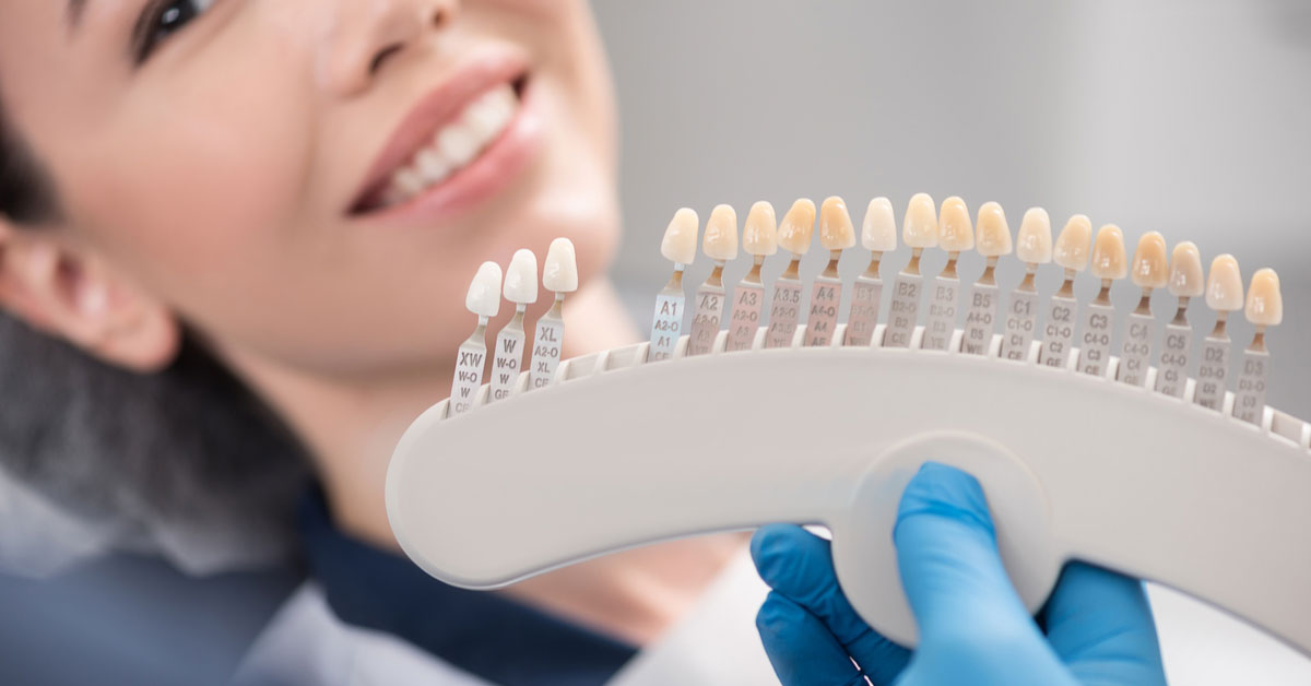 The Beauty of Composite Veneers for a Flawless Smile in Dubai