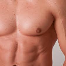 The Impact of Gynecomastia on Men's Health