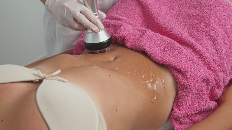 Transform Your Body: The Laser Liposuction Experience