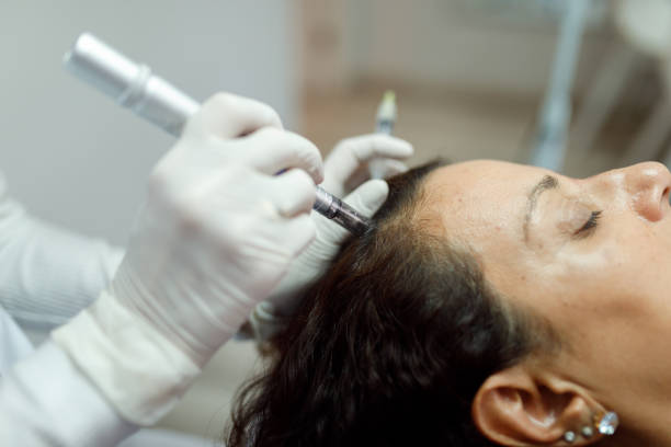 What Should You Expect During a Microneedling Session?