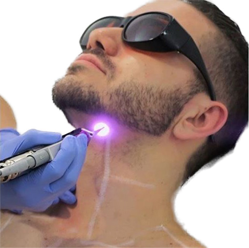 Male Laser Hair Removal Magic: Before and After Transformation in Dubai